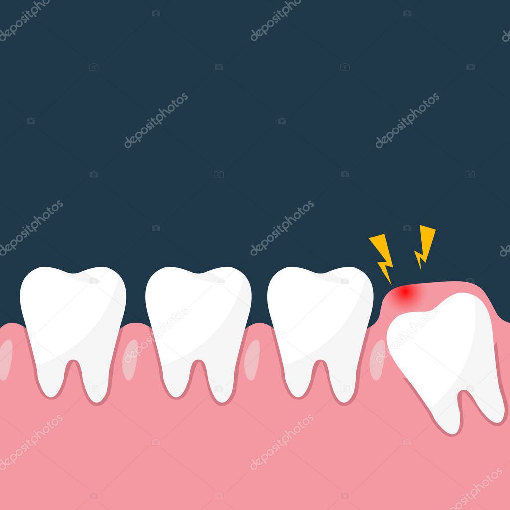 gum problems. Impacted wisdom tooth for dentistry and dental surgery