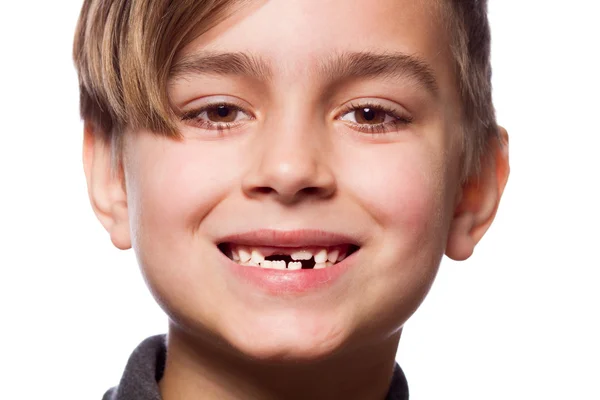 Retrato de menino com um dente perdido — Fotografia de Stock