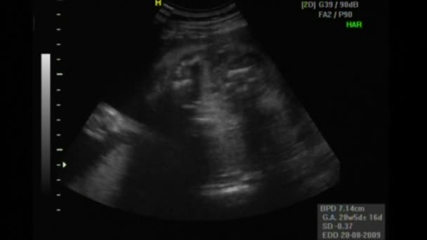 2D en 3D echografie van een mooie baby op 23 weken dracht — Stockvideo