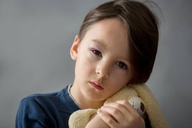 Gözü morarmış, morarmış, çocuk istismarı ve yaralanmış küçük bir okul çocuğu.