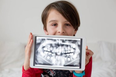 Çocuk, reşit olmayan bir çocuk, elinde diş röntgeninin çekildiği bir tablet var.
