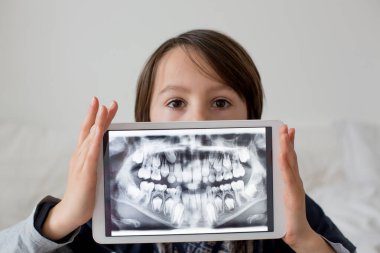 Çocuk, reşit olmayan bir çocuk, elinde diş röntgeninin çekildiği bir tablet var.