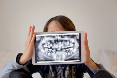 Çocuk, reşit olmayan bir çocuk, elinde diş röntgeninin çekildiği bir tablet var.