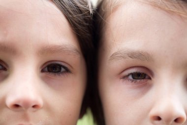 İki erkek kardeş göz, kardeşler yan yana.