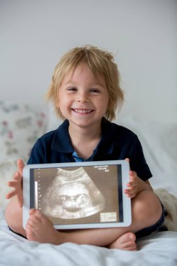 Küçük tatlı çocuk, ultrasonda doğmamış küçük kız kardeşinin fotoğrafını tutuyor.
