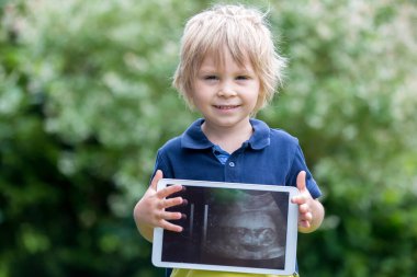 Küçük tatlı çocuk, ultrasonda doğmamış küçük kız kardeşinin fotoğrafını tutuyor.