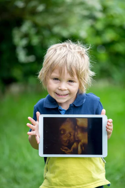 可爱的幼儿 用超声波拍下了他未出生的妹妹的照片 — 图库照片