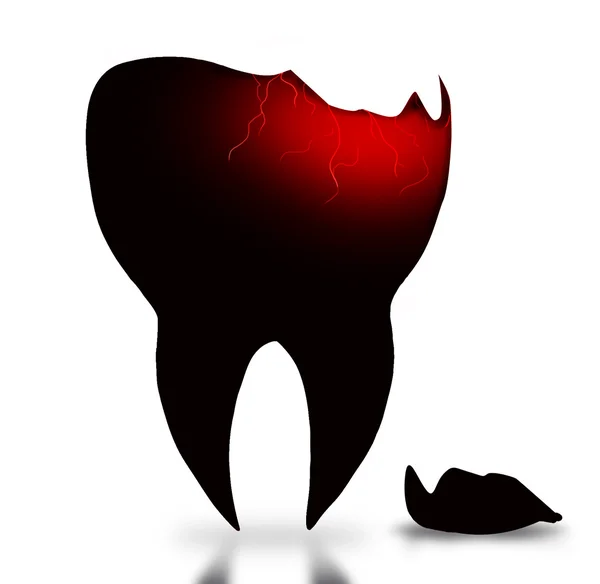 Sjuk tand med spricka — Stockfoto
