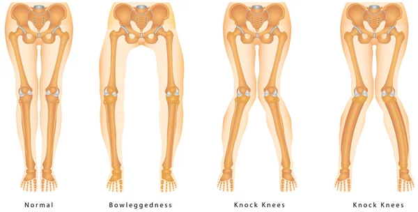 Bandy-kaki. Bentuk kaki-kakinya. - Stok Vektor