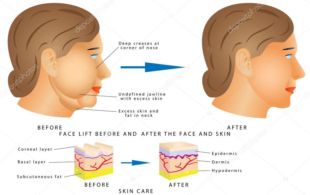 Illustration facial aging changes Trample footjob cum