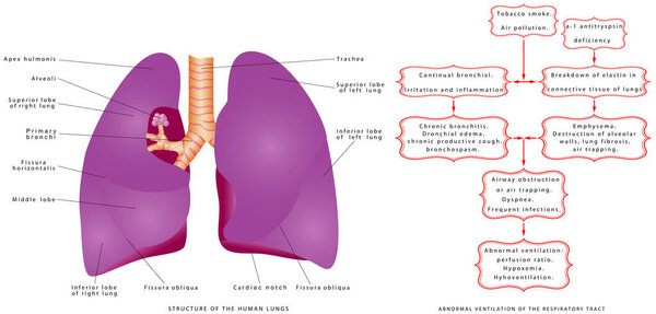 Расстройства дыхательных путей. Дыхание и здоровье. Верхний (синусит, отит, тонзиллит, ларингит) и нижний (острый бронхит, пневмония, туберкулез легких)