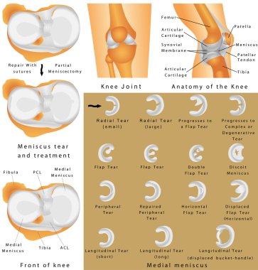 Anatomy of the Knee clipart