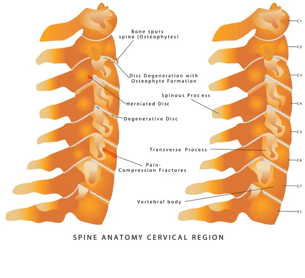 Espinha cervical — Vetor de Stock