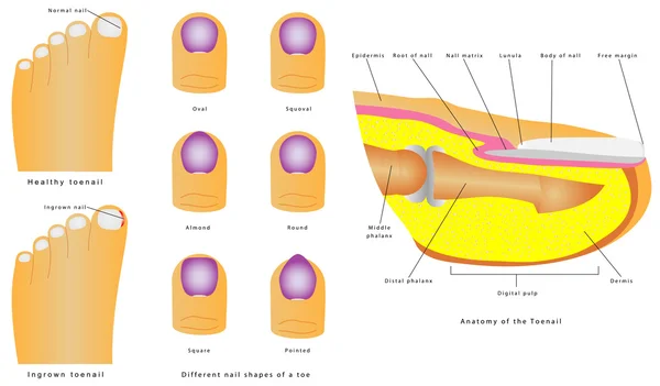 Ongle de pied — Image vectorielle