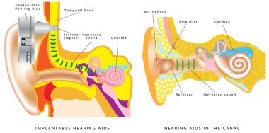 Ear hearing aid. clipart