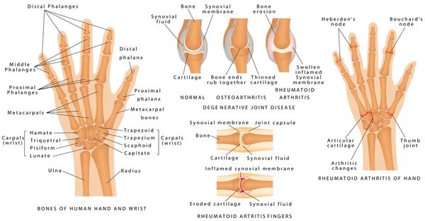 Skeletal System Phalanges — Stock Vector