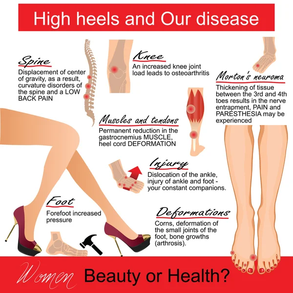 Sepatu hak tinggi dan penyakit kami. Infografic - Stok Vektor