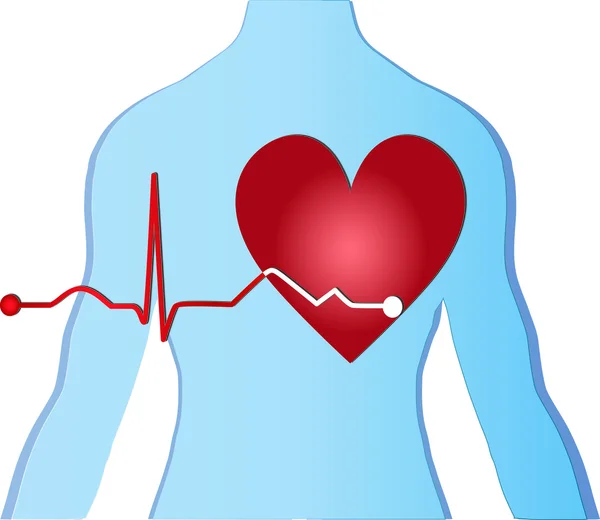 Srdce tělo ekg — Stockový vektor