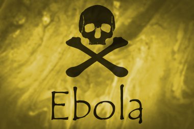 Ebola virüsü