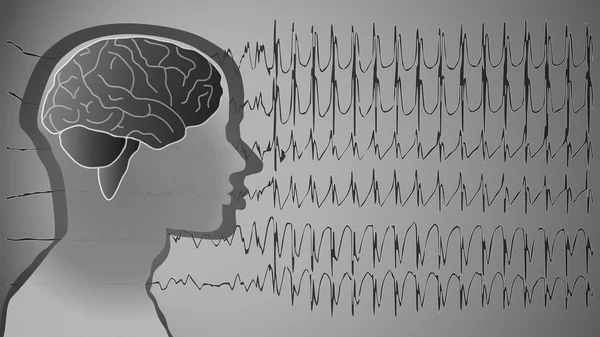 Medical background brain epilepsy — Stock Photo, Image