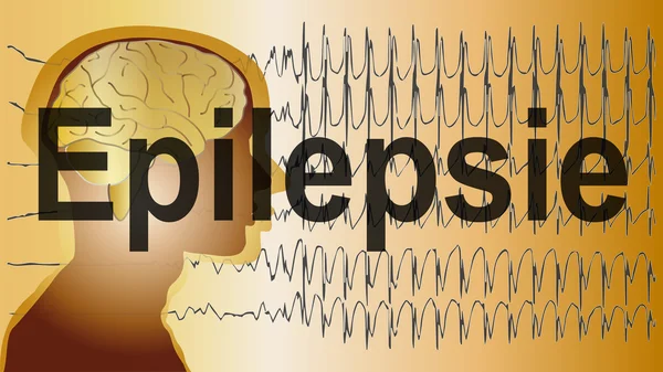 Medical background brain epilepsy — Stock Photo, Image