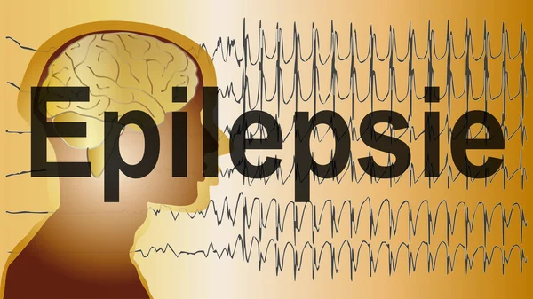 Medizinischer Hintergrund Hirnepilepsie — Stockfoto