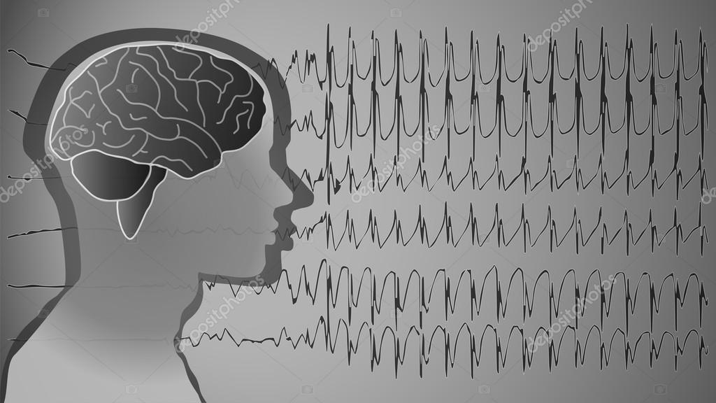 Medical Background Brain Epilepsy Stock Photo Image By C Drnn 61421771