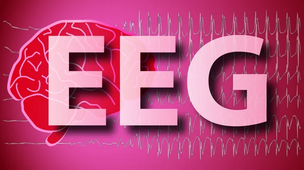 Beyin Eeg tıbbi Epilepsie