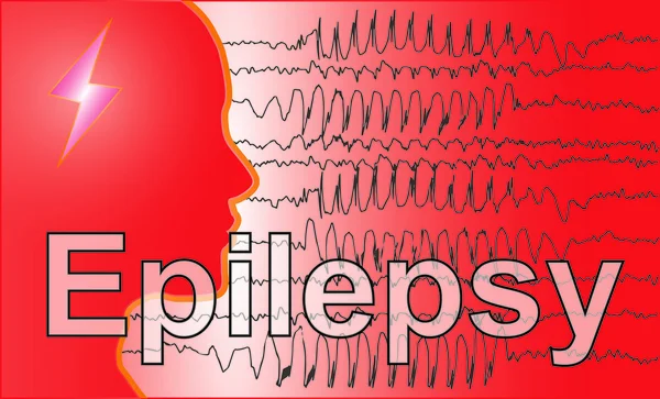 Cerebro EEG médico Epilepsie — Foto de Stock