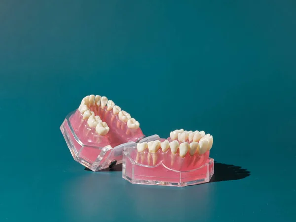 Zestaw Sztucznych Zębów Przezroczystym Plastikowym Pojemniku Zielonym Tle — Zdjęcie stockowe