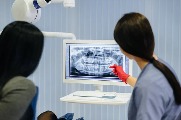 Dentysta Pokazuje Zdjęcie Zębów Pacjenta Informuje Niezbędnym Leczeniu Stomatologia Zdrowie — Zdjęcie stockowe