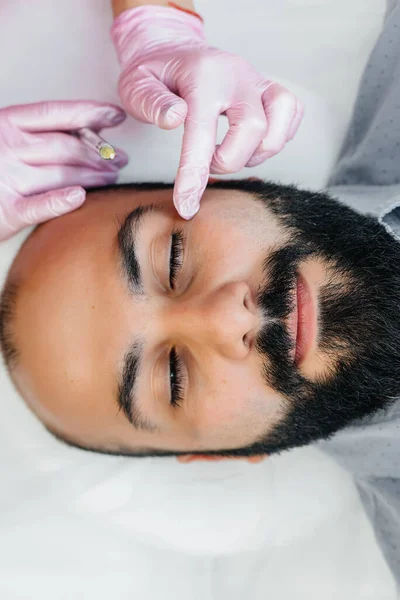 髭の男のためのリップ増強としわ除去のための化粧品手順 化粧品 — ストック写真