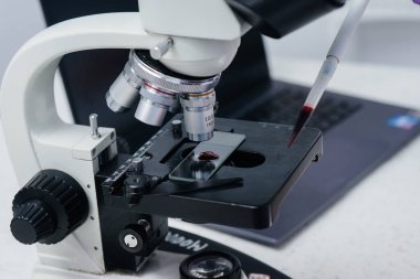 Bulaşıcı hastalık doktoru mikroskopta çalışıyor. Tıp laboratuarında virüsler ve bakteriler üzerine çalışma