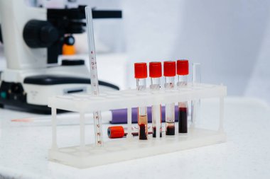 Laboratuvarda kan tahlili yapılan tıbbi test tüpleri.