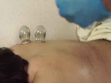 Bir tıp uzmanı hastayı tedavi etmek için cam kavanozlar kullanır.