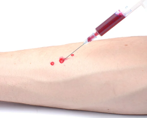 Blod provtagning med sprutan och nålen för analys — Stockfoto
