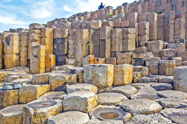 Vue Sur Les Célèbres Rochers Bushmills Avec Une Personne Éloignée — Photo