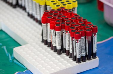 test tüpleri ile bir tepsi üzerinde kan