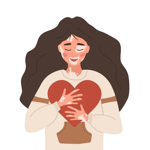 Mulher com vitiligo. Autocuidado e amor próprio. Dia mundial do vitiligo. Doença da pele. Menina feliz abraçando o coração. Ilustração vetorial em estilo de desenho animado plano — Vetor de Stock