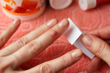 Onun parmak ve yara için sıva üzerine kesim