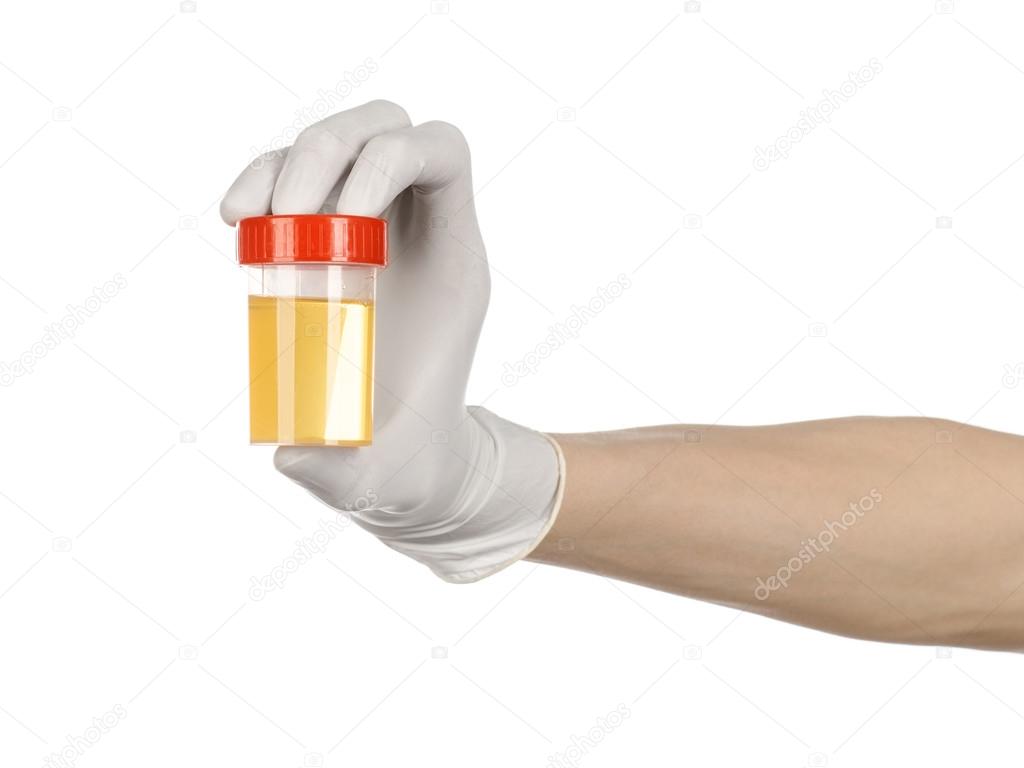 Medical theme: doctor's hand in white gloves holding a transparent container with the analysis of urine on a white background