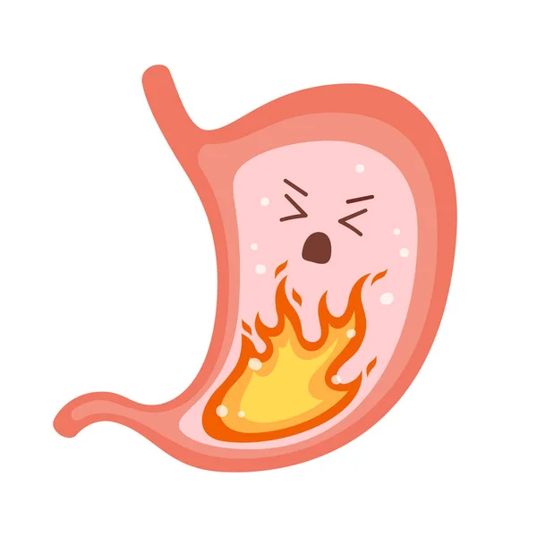 Människans mage brinner. Halsbränna, gastrit och sura uppstötningar, matsmältningsbesvär och magsmärtor. Vektor platt tecknad illustration — Stock vektor