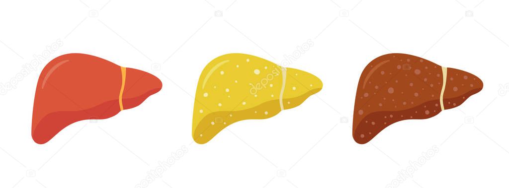 Stages of nonalcoholic liver damage. Healthy, fatty and cirrhosis. Liver Disease.