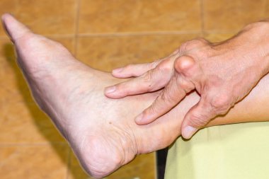 Yaşlılık ve ilaç hastalıkları eklem ağrısı, kemik ağrısı, gut, eklem iltihabı, kol, ayak, diz, romatizma semptomları, soyut acı ve umutsuzluk konsepti olan erkeklerde şiddetli gut hastalığı