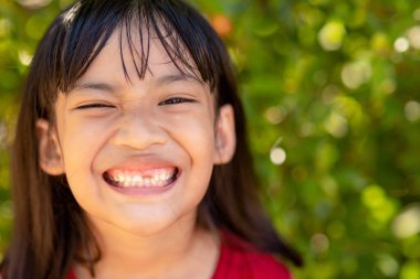 little girl showing her broken milk teeth