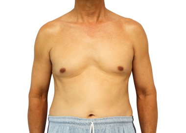 Eski hasta izole arka plan üzerinde vücut