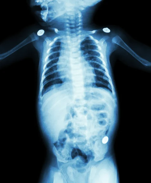 Película de rayos X de todo el cuerpo del bebé —  Fotos de Stock