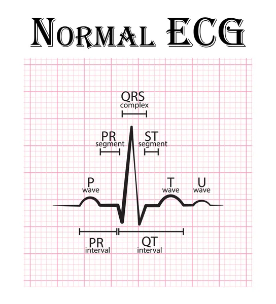 Normalt EKG (elektrokardiogram) (P-våg, PR-segment, PR-intervall, QRS-komplex, QT-intervall, St-segment, T-våg, U-våg ) — Stock vektor