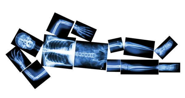 Kemiğin insan uyuyor