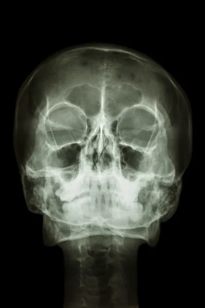 Нормальний череп людини і шийний хребет — стокове фото